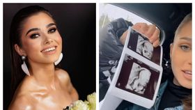 Theo Rose a făcut publică prima ecografie a bebelușului. Ce detaliu a observat artista la scurt timp după ce a fost la control